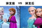 冰雪女王掉发对比图