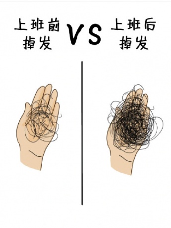 Comparison of hair loss before and after work emoticon pack