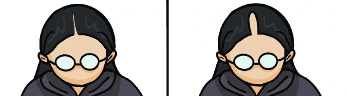 A complete collection of pictures of hair loss emoticons